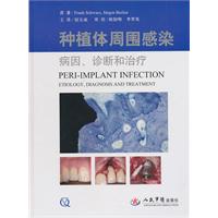 牙种植体周围感染病因、诊断和治疗