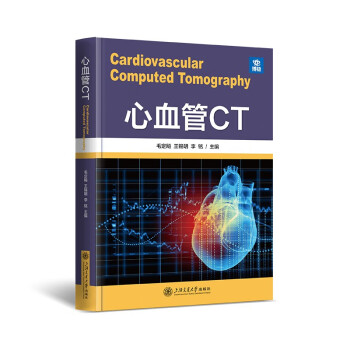 心血管CT