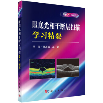 眼底光相干断层扫描学习精要--眼科入门系列