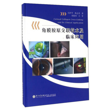 角膜胶原交联技术及临床应用(精)