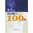 脊柱侧凸100问